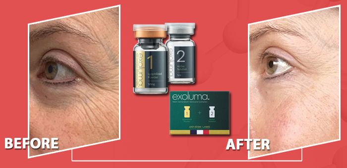 exoluma экзосомы до и после